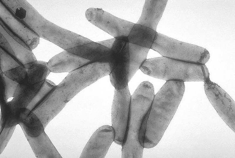 800px-Legionella_pneumophila_01